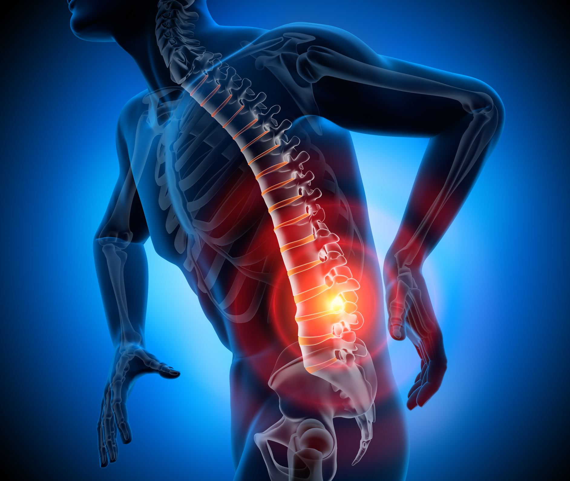 Chronic Back Pain: Common Causes and How to Treat Them