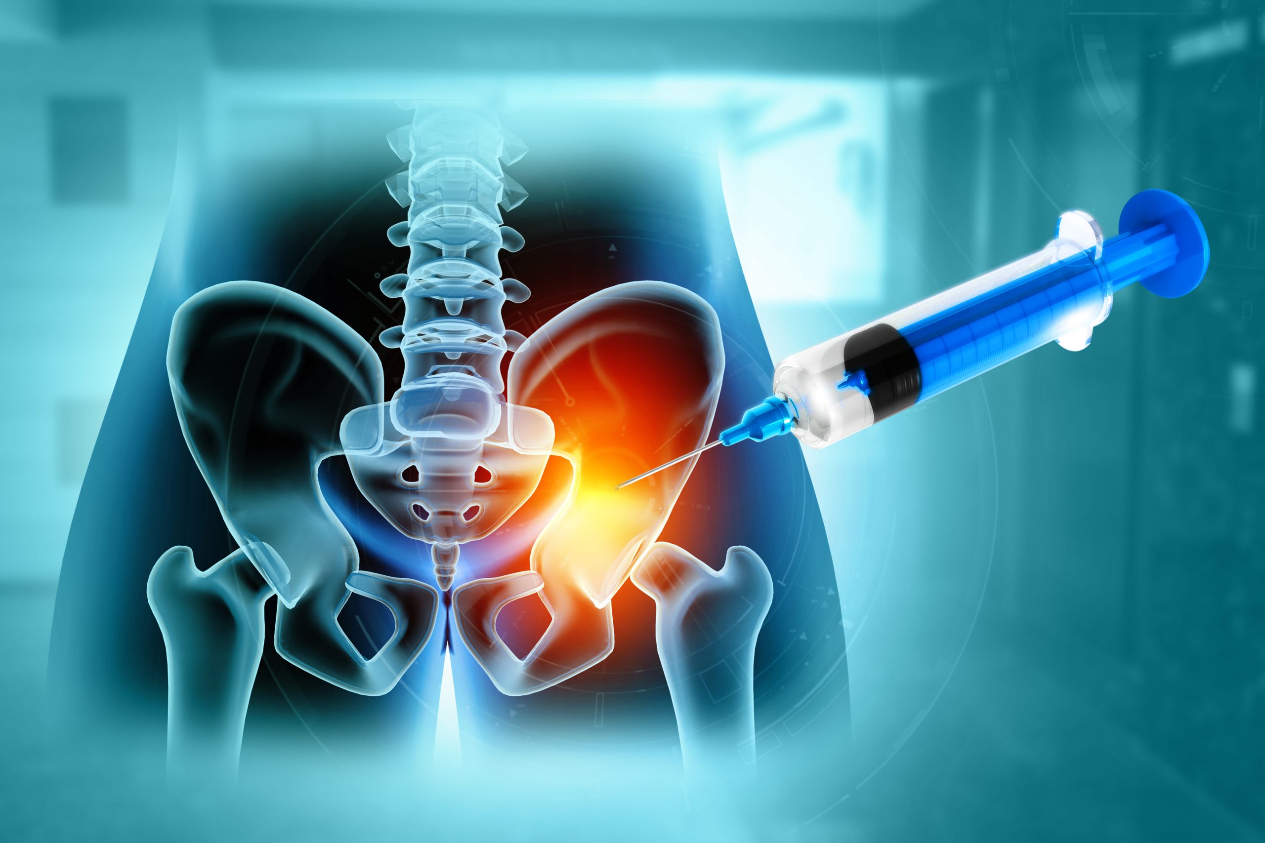 SpineArt surgery process for Sacroiliac Joint Injections